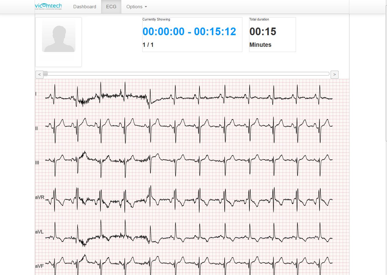 Gocardio, a mobile system development for cardiac rehabilitation