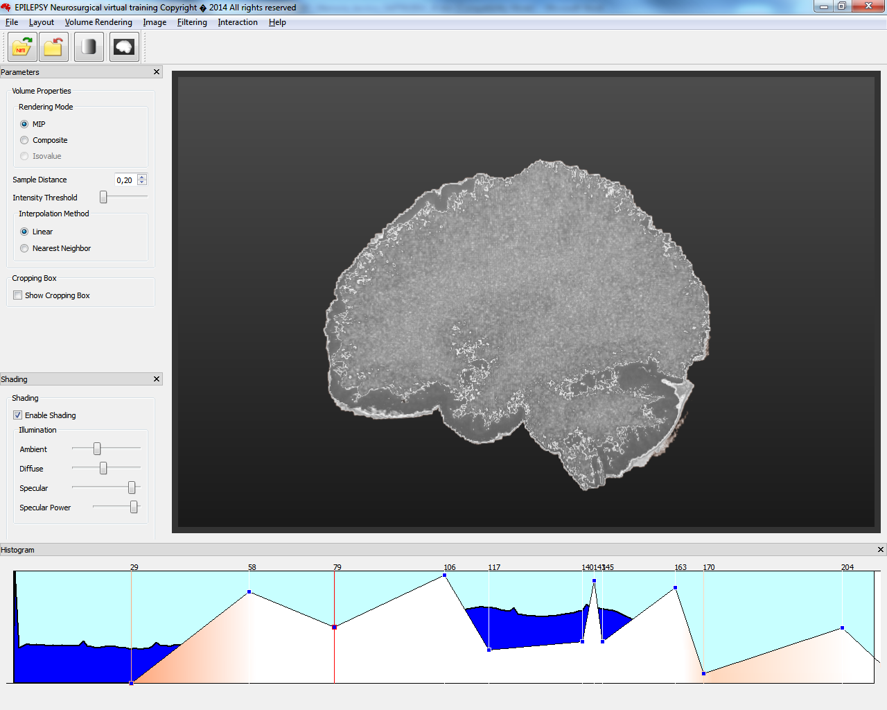 A virtual tool allows epilepsy surgery training (e-Pilepsy)